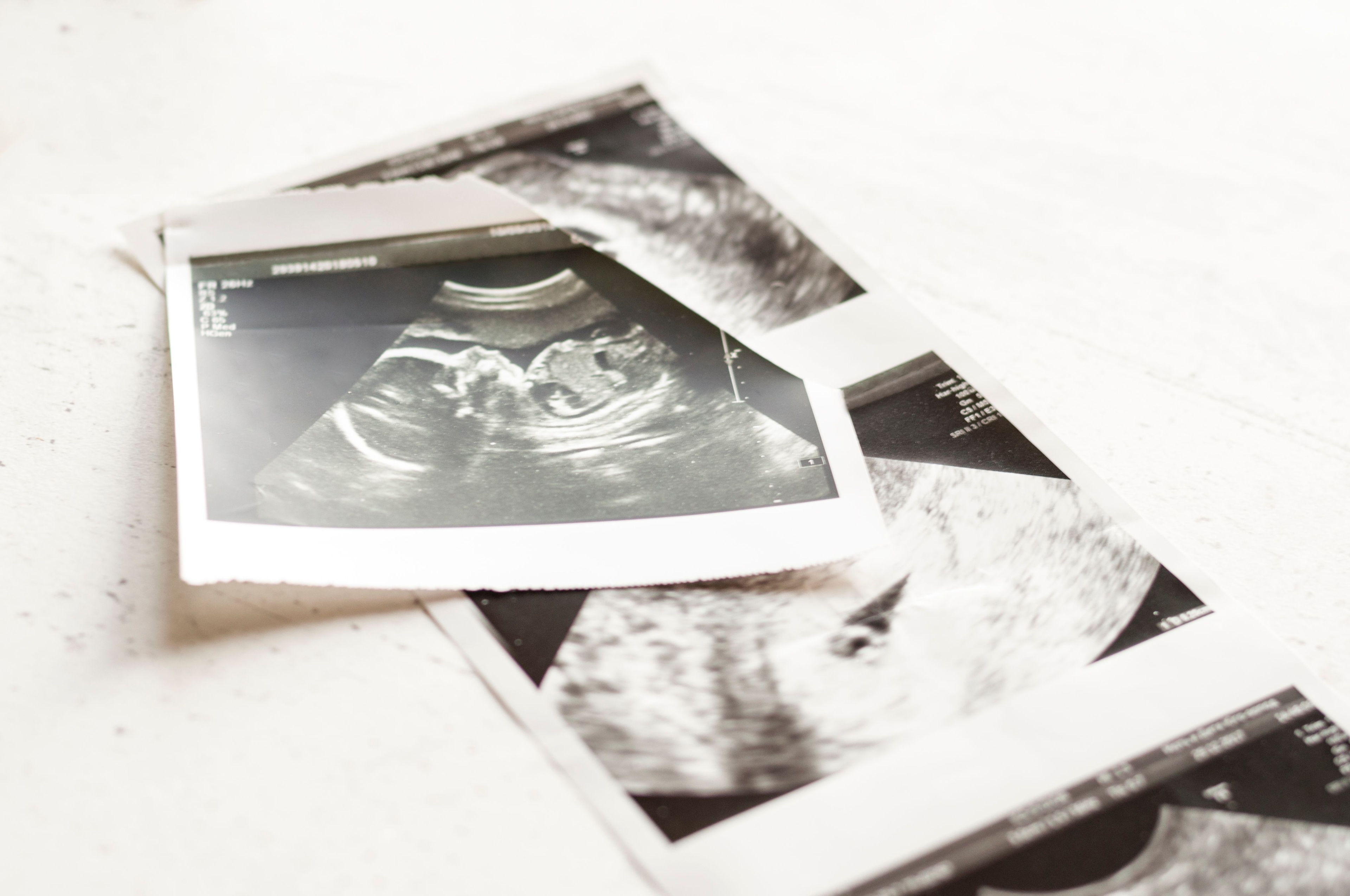 Ultrasound photos